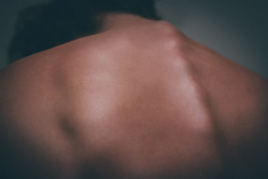 Photo muscle soreness